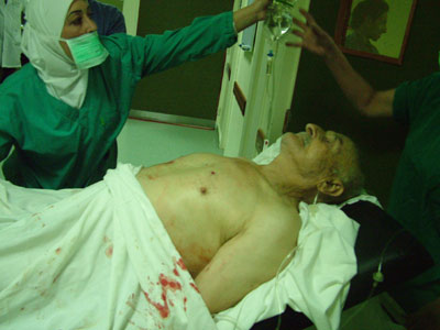 Eighty year old latest victim of cluster bomb explosion 
