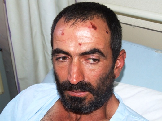 Al Intiqad Report: “Israeli” Enemy Releases Abducted Shepherd, Leaves Terrorism Scars All over His Body
