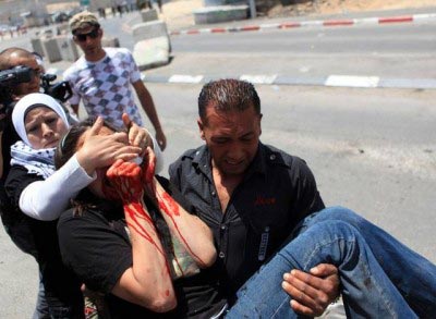 Emily Henochowicz US Peace Activist Loses Eye in Peaceful Protest against Flotilla Attack