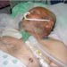 The Gaza siege claims its 115th victim