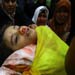 Gaza death toll rises to 400, 2000 Injured, 220 critically