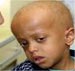 Depleted Uranium behind rise of Iraqi cancer figures 