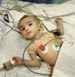 “Israel” bans entrance of medical devices to Gaza