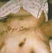 Rights Movement: “Israel” Harvested Organs from Christian Palestinian in 1988