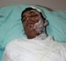 “Israelis” Beat, Pour Boiling Water on Palestinian Worker