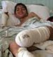 6,500 Disabled Children in Gaza after War