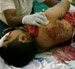 Human Rights Watch Report: Bahrain Used Torture in Interrogation with Suspects