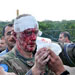 French UNIFIL under Attack