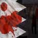 Bahraini Youth Hit, Tortured to Death
