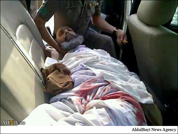 In Photos: Saudi Police Injures, Arrests Ayatollah Nemer, Kills Two Protesters 