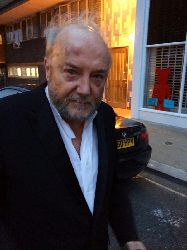 British MP Galloway Released after Being Brutally Beaten over ’Israel’ Views