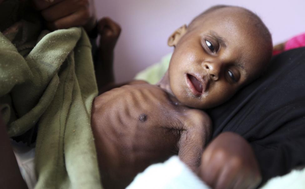  Merciless Saudi Aggression: Going Hungry in Yemen