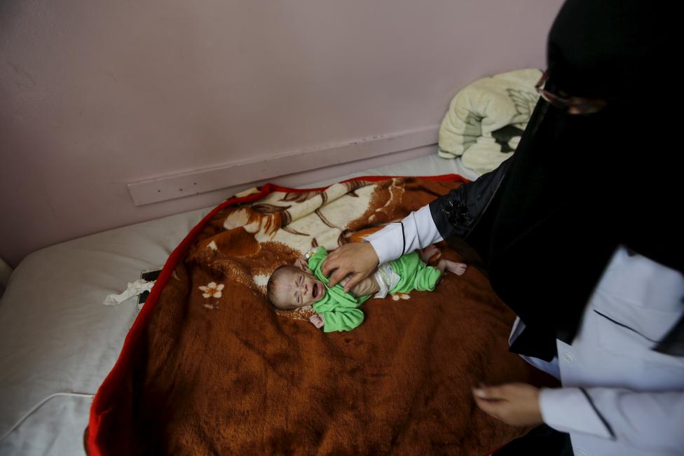  Merciless Saudi Aggression: Going Hungry in Yemen
