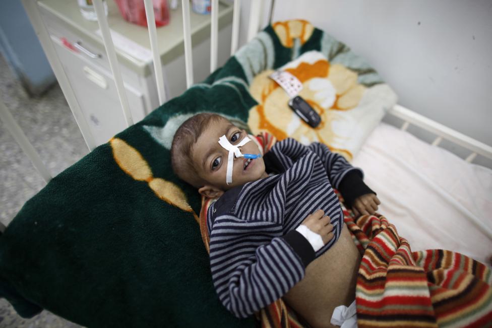  Merciless Saudi Aggression: Going Hungry in Yemen