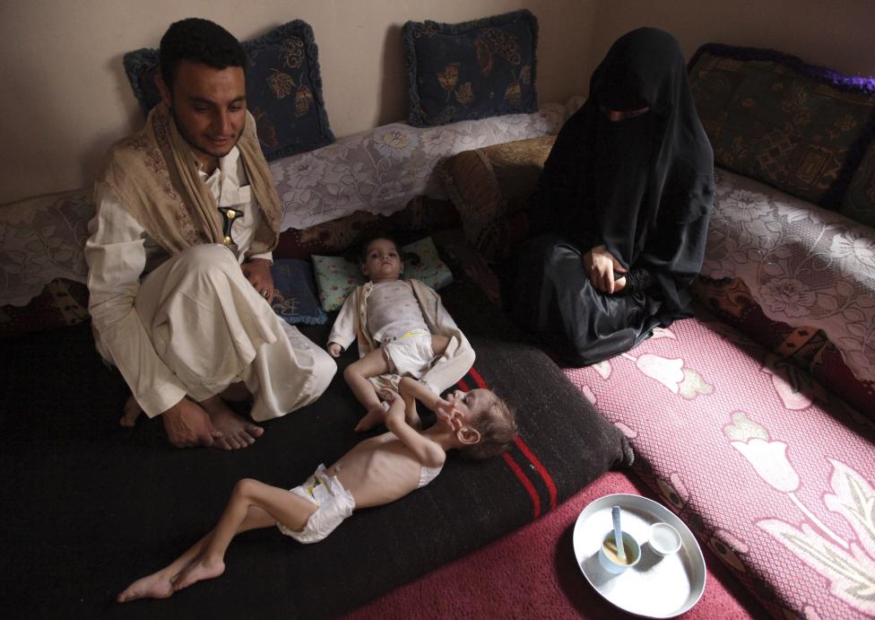  Merciless Saudi Aggression: Going Hungry in Yemen