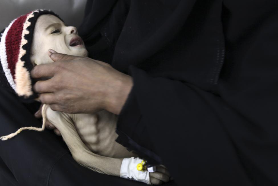  Merciless Saudi Aggression: Going Hungry in Yemen