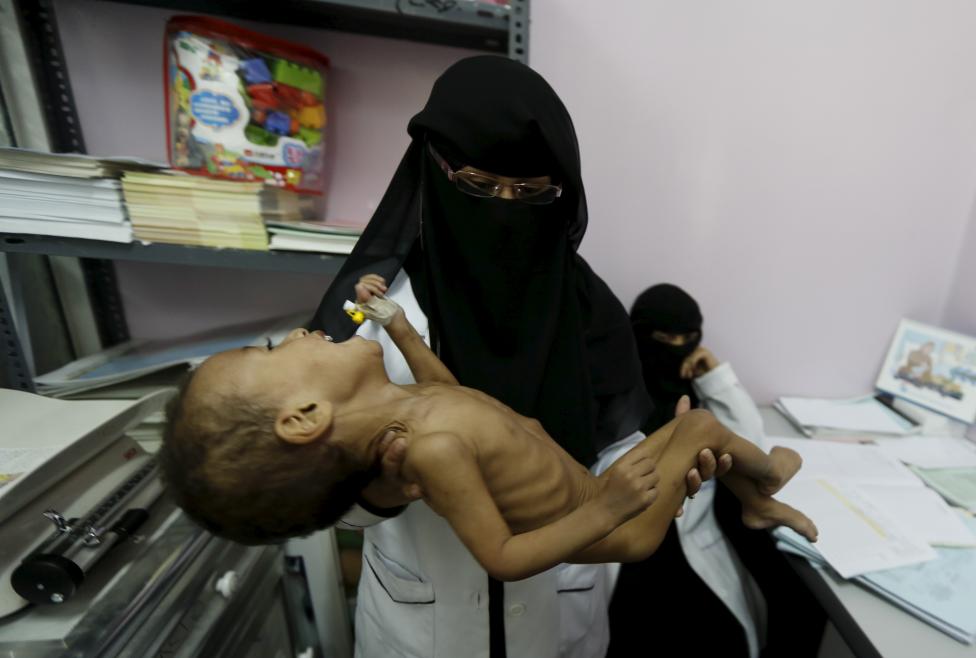  Merciless Saudi Aggression: Going Hungry in Yemen