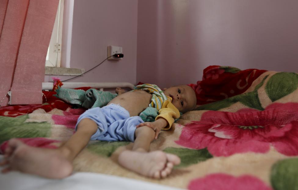  Merciless Saudi Aggression: Going Hungry in Yemen