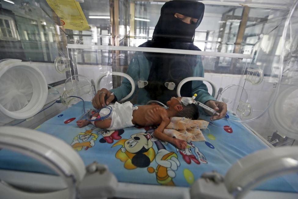  Merciless Saudi Aggression: Going Hungry in Yemen