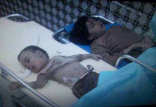 Al-Saud “Firmness” against Yemeni Children In Photos: Al-Saud “Firmness” against Yemeni Children