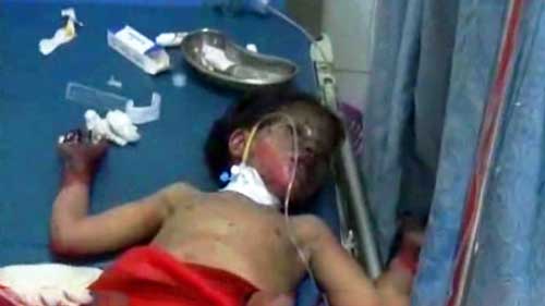 Al-Saud “Firmness” against Yemeni Children In Photos: Al-Saud “Firmness” against Yemeni Children