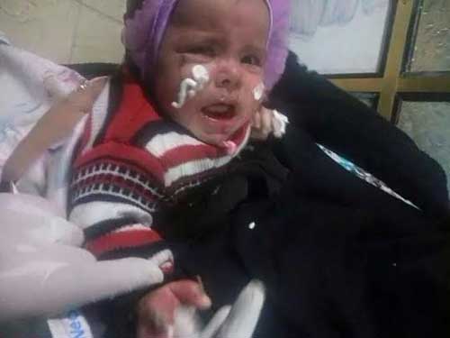 Al-Saud “Firmness” against Yemeni Children In Photos: Al-Saud “Firmness” against Yemeni Children