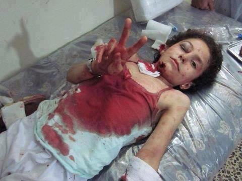 Photo Report: Gaza’s Epic: Children’s Blood, Will Conquer Pain