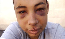 Tariq Abu Khdeir: I Will Never Think of Freedom in the Same Way Again
