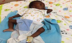 Baby Born with 4 Arms, 4 Legs Recovering Well after Surgery