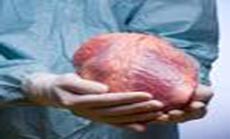 World’s 1st ’Dead Heart’ Transplants Successful