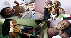  Merciless Saudi Aggression: Going Hungry in Yemen