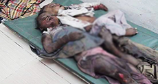 The Guardian View on Yemen’s War: A Year of Living Shamefully
