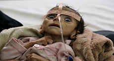 Baby That Starved to Death Tells Tragic Story of Yemen War
