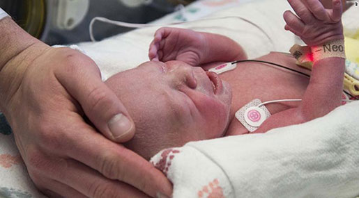 Baby Is First To Be Born In US after Uterus Transplant