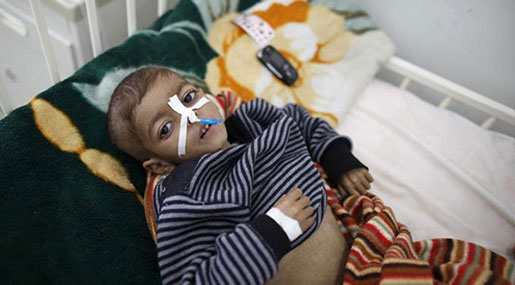 Western Leaders Told to Stop ’Stoking the Flames of War’ in Yemen