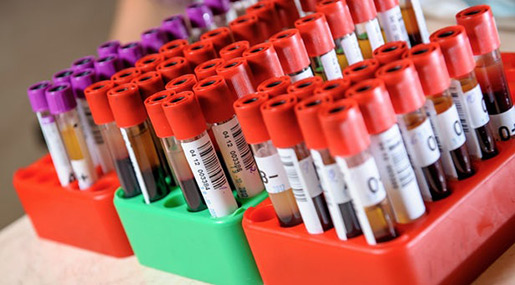 New Blood Test Can Detect Autism in Children