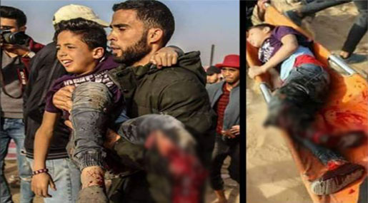 ’Israeli’ Regime Denies 11-Yo Wounded Palestinian’s Passage for Medical Treatment, Causes Loss of His Leg