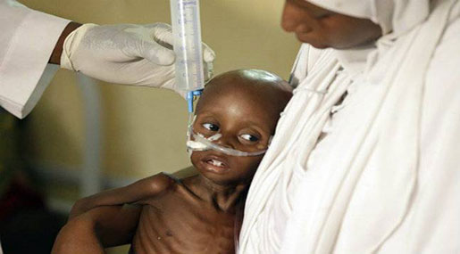 UNICEF Warns: 400,000 Children at Risk of Starvation in Nigeria