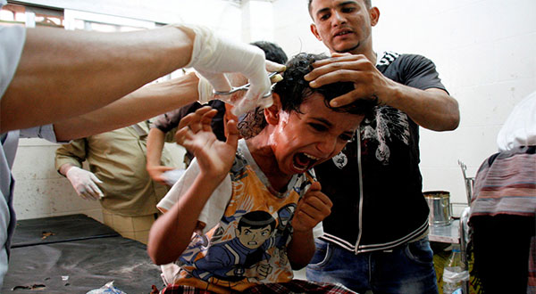 More than a 1000 Days of War on Yemen [Photos]