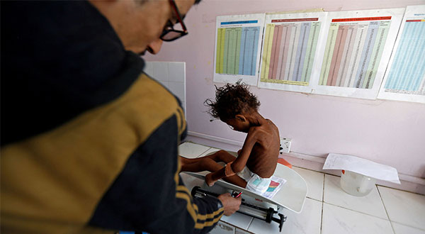More than a 1000 Days of War on Yemen [Photos]