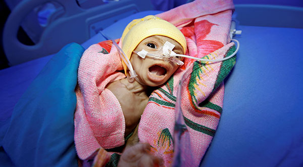 More than a 1000 Days of War on Yemen [Photos]