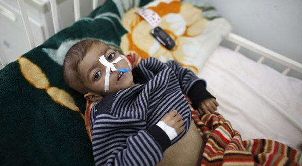 Western Leaders Told to Stop ’Stoking the Flames of War’ in Yemen