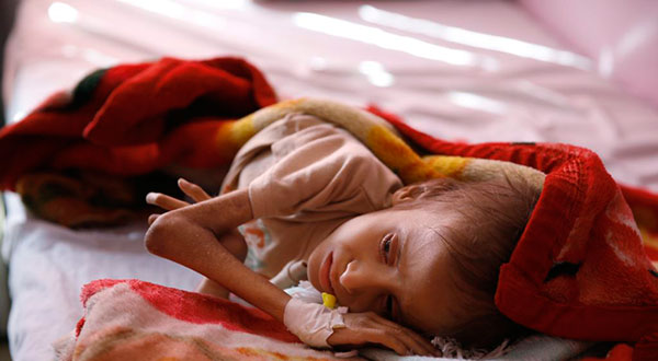Yemen's Children Risk Death as Fuel Shortage Creates Water Crisis Yemen’s Children Risk Death as Fuel Shortage Creates Water Crisis