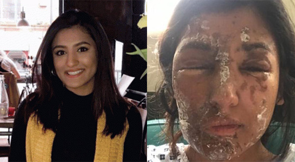 Are Muslims Being Targeted With Acid Attacks?