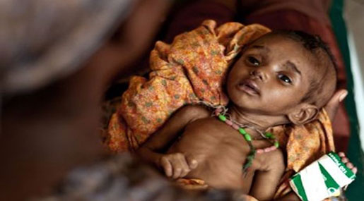 1/3 Children Malnourished in Drought-Hit Kenya