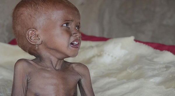 The UK Hypocritically Condemns Blockades in Syria but Not In Yemen The UK Hypocritically Condemns Blockades in Syria but Not In Yemen