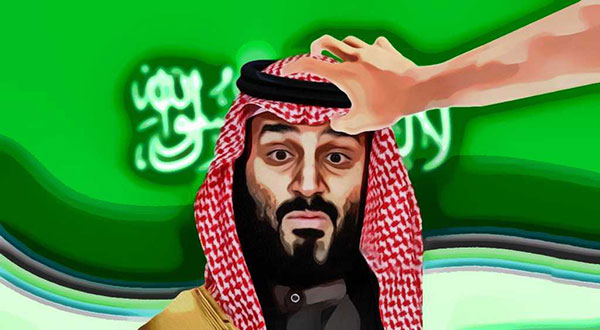 MBS