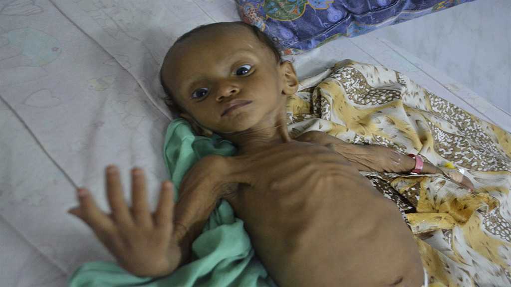UN Warns: +7 Million Yemeni Children Face ’Serious’ Famine Threat