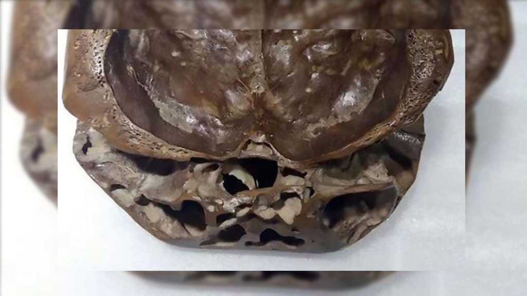 Alleged «Alien Skull» Displayed in Beijing
