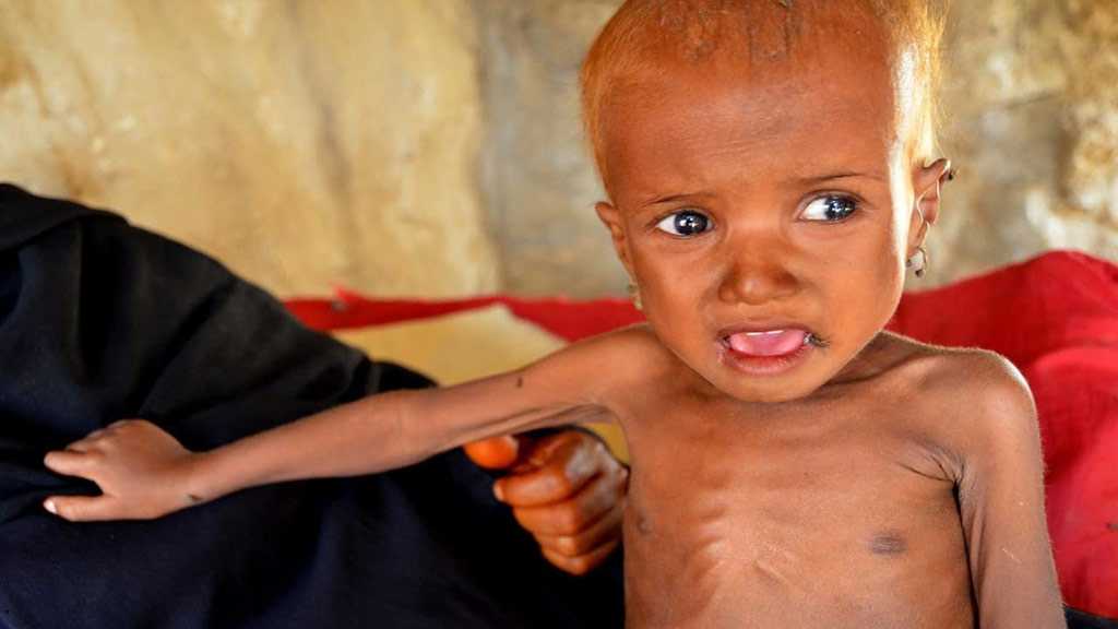 UN: 7,500+ Children Killed, Wounded in Yemen since 2013